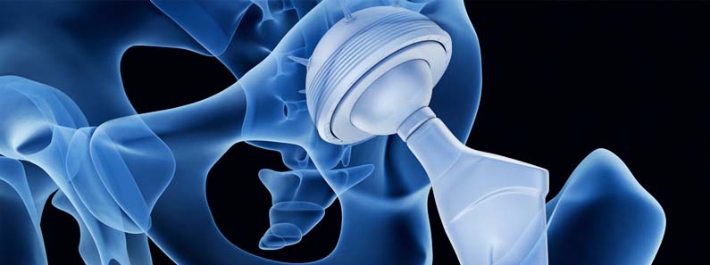 joint & spine surgery in medicity hospital kharghar navi mumbai