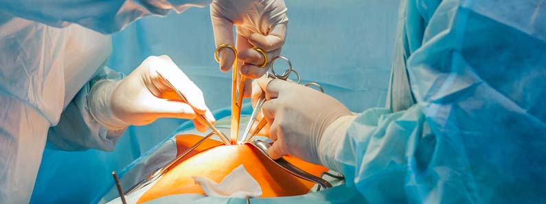 laproscopy surgery in medicity hospital kharghar navi mumbai