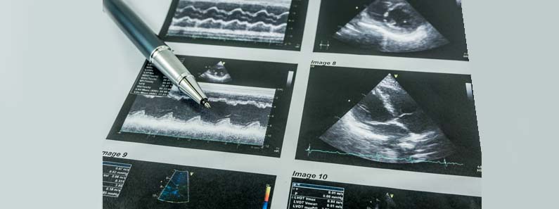 2d echo in medicity hospital kharghar navi mumbai