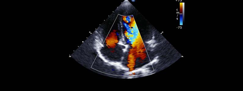 colour-doppler-medicity-kharghar