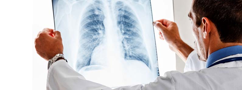 digital xray in medicity hospital kharghar navi mumbai